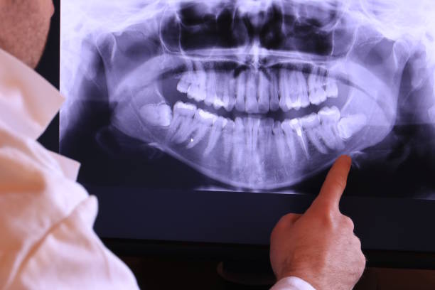 Best Cracked Tooth Emergency Dentist  in Alvin, TX